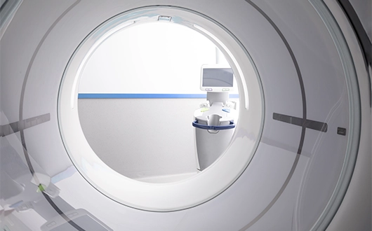 PET-CT