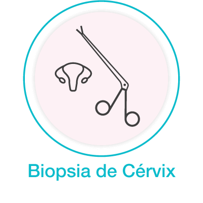 Biopsia de Cérvix